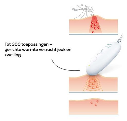 BR 10 Appareil soulageant les piqûres d’insectes  Beurer